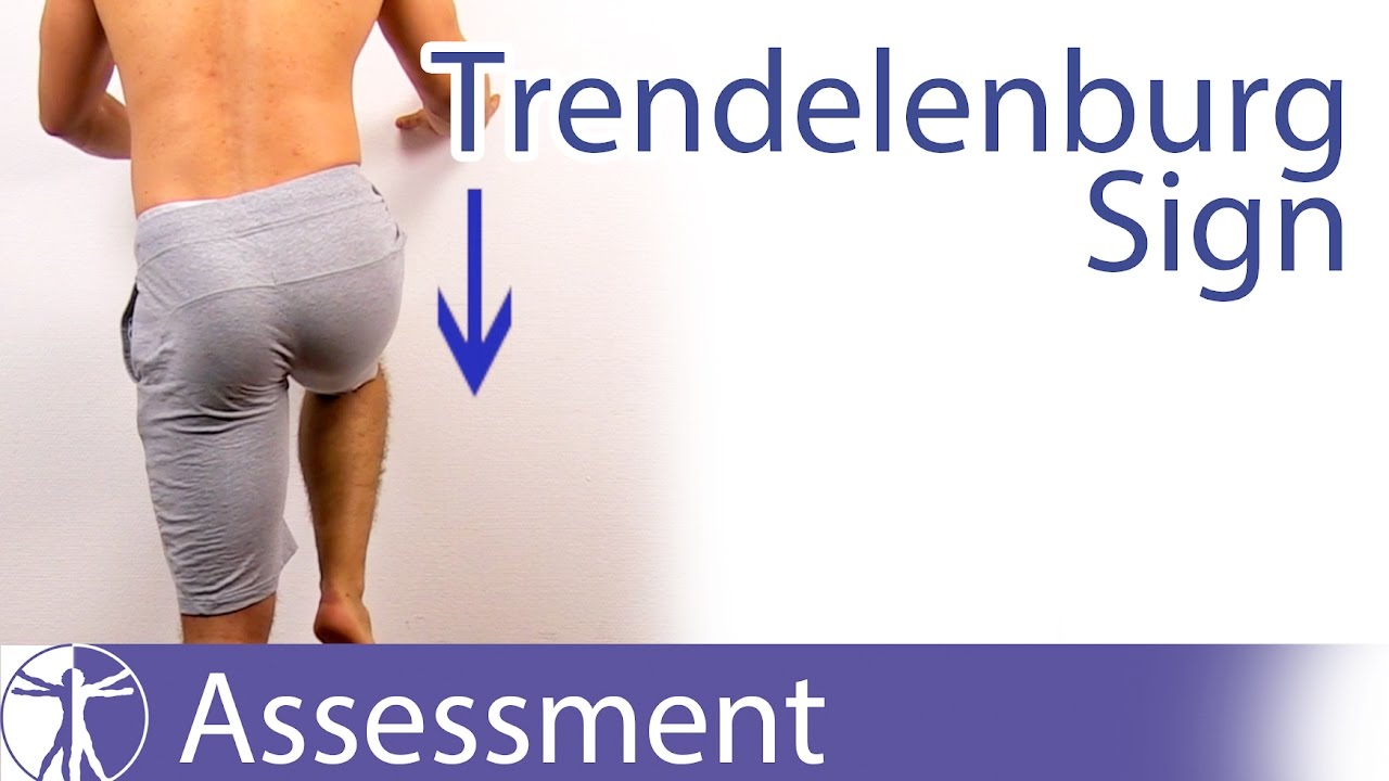 Trendelenburg Sign | Hip Abductor Weakness