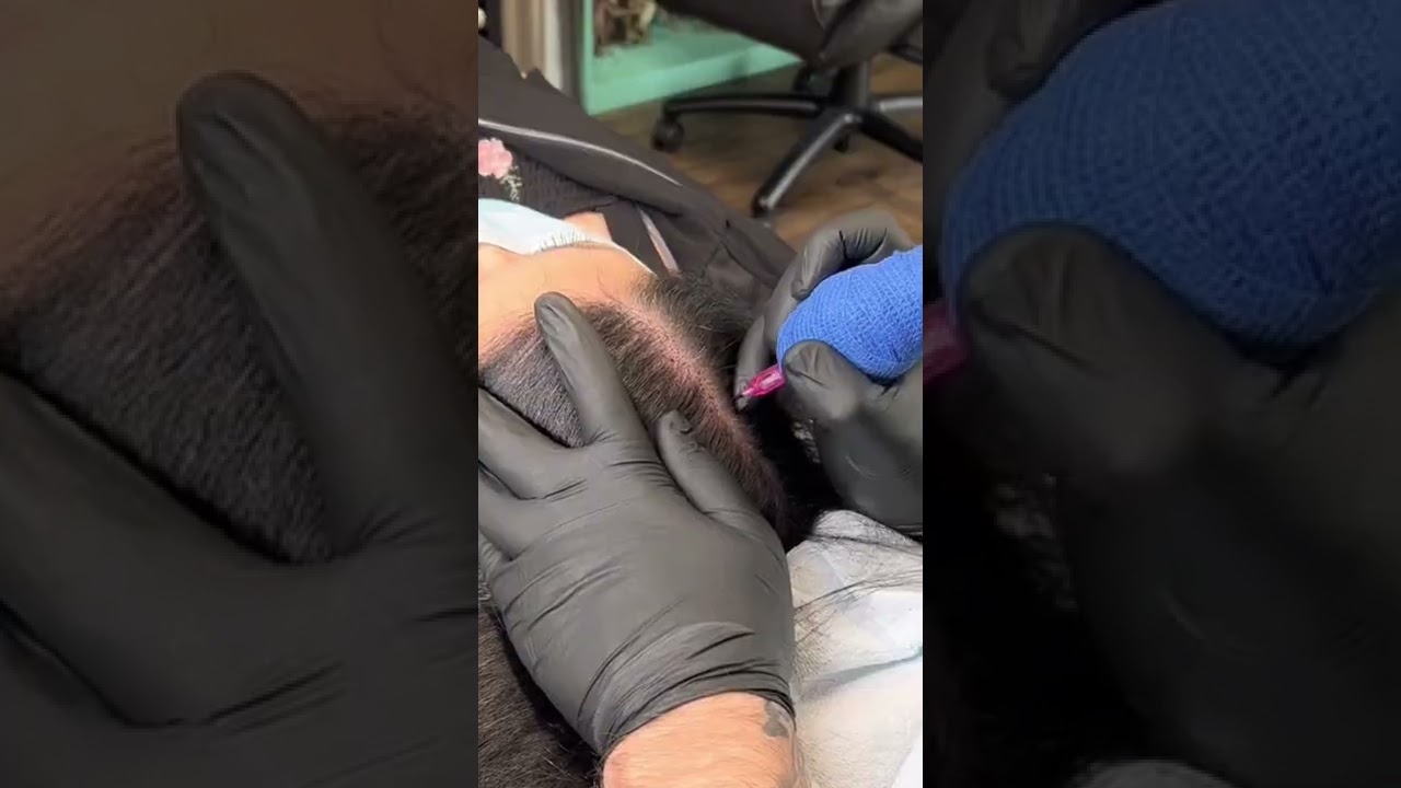⚡️ Female SMP treatment - Scalp Micro Pigmentation Edmonton