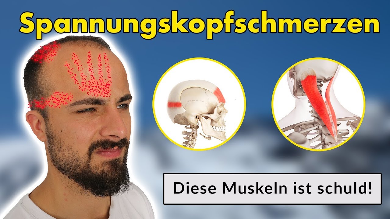 Spannungskopfschmerzen ( ist eine Muskelverspannung) | Ursache & Lösung