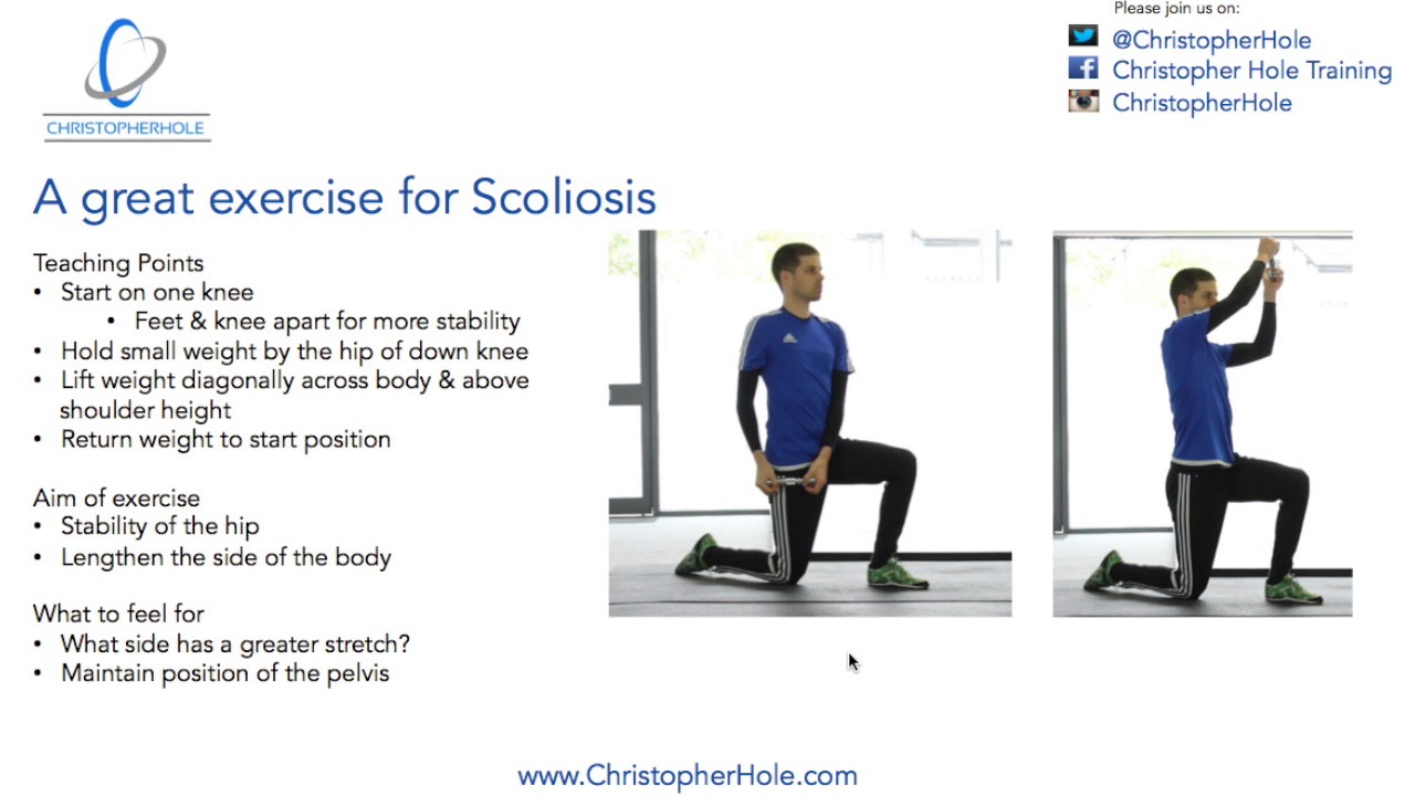 Scoliosis Exercise: A great exercise