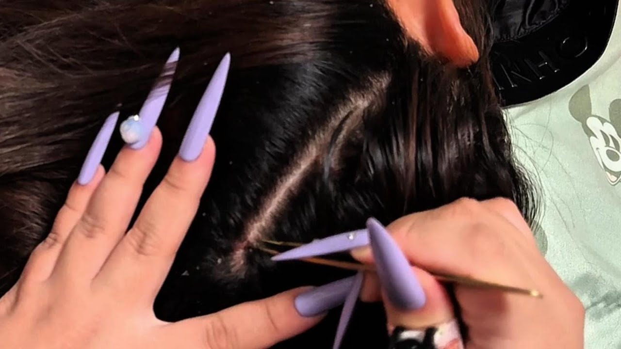 Gentle Scalp Care ASMR with Precise Tweezer Sounds | No Talking | May