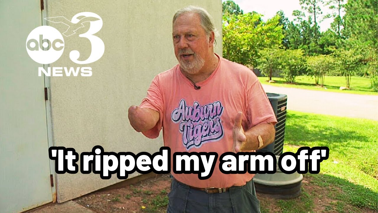 Man describes surviving shark attack in Gulf Shores, Alabama