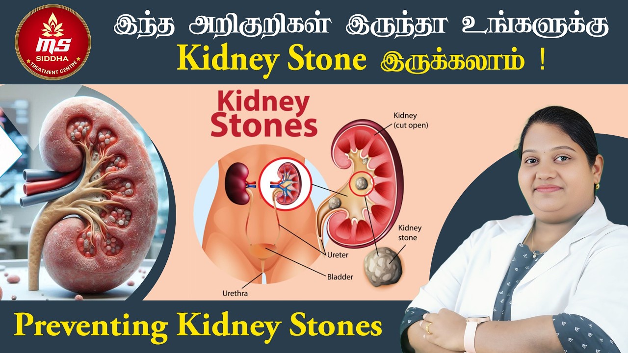 இந்த அறிகுறிகள் இருந்தா உங்களுக்கு Kidney Stone இருக்கலாம் ! Preventing Kidney Stones !
