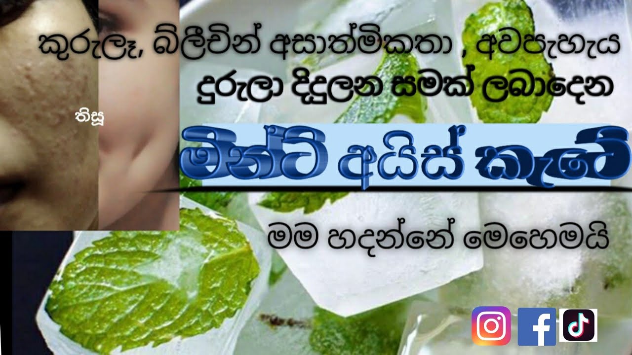 කුරුලෑවලට හරියට ගැලපෙන මින්ට් අයිස් කැටේ  , සීයට සීයක් ප්‍රතිඵල සහිතයි , /mint ice cubes for acne