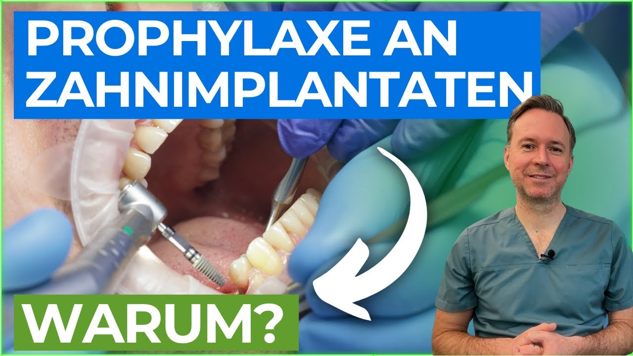 Warum ich die Prophylaxe für Zahnimplantate so wichtig finde!