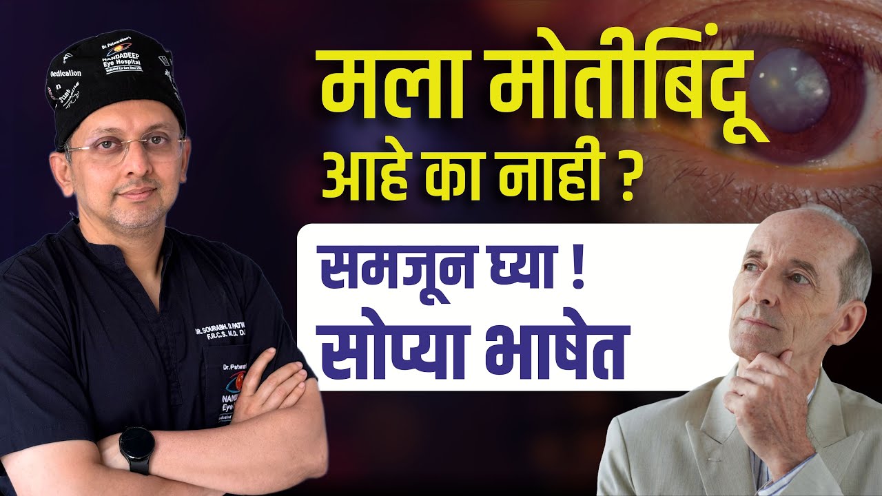 मोतिबिंदू म्हणजे काय? मोतीबिंदू कसा ओळखावा? Cataract Explained | All Your Questions Answered