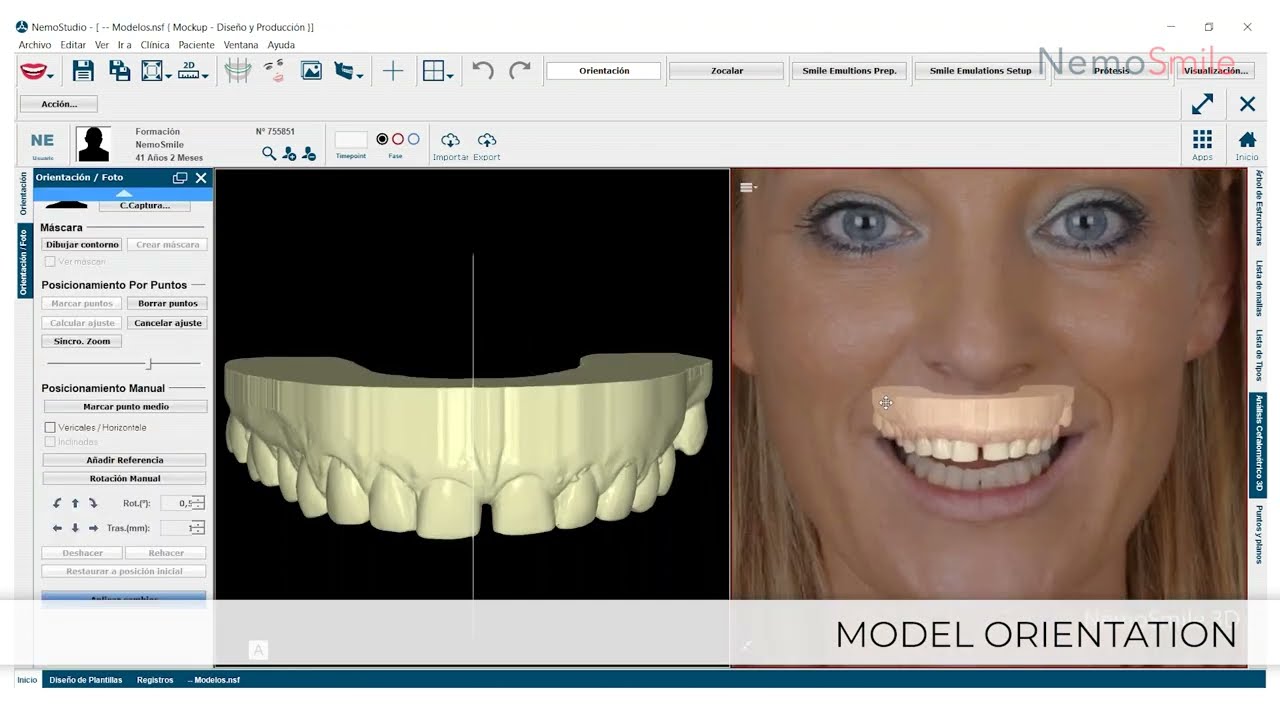 NemoSmile Demo - Digital Smile Design software_English