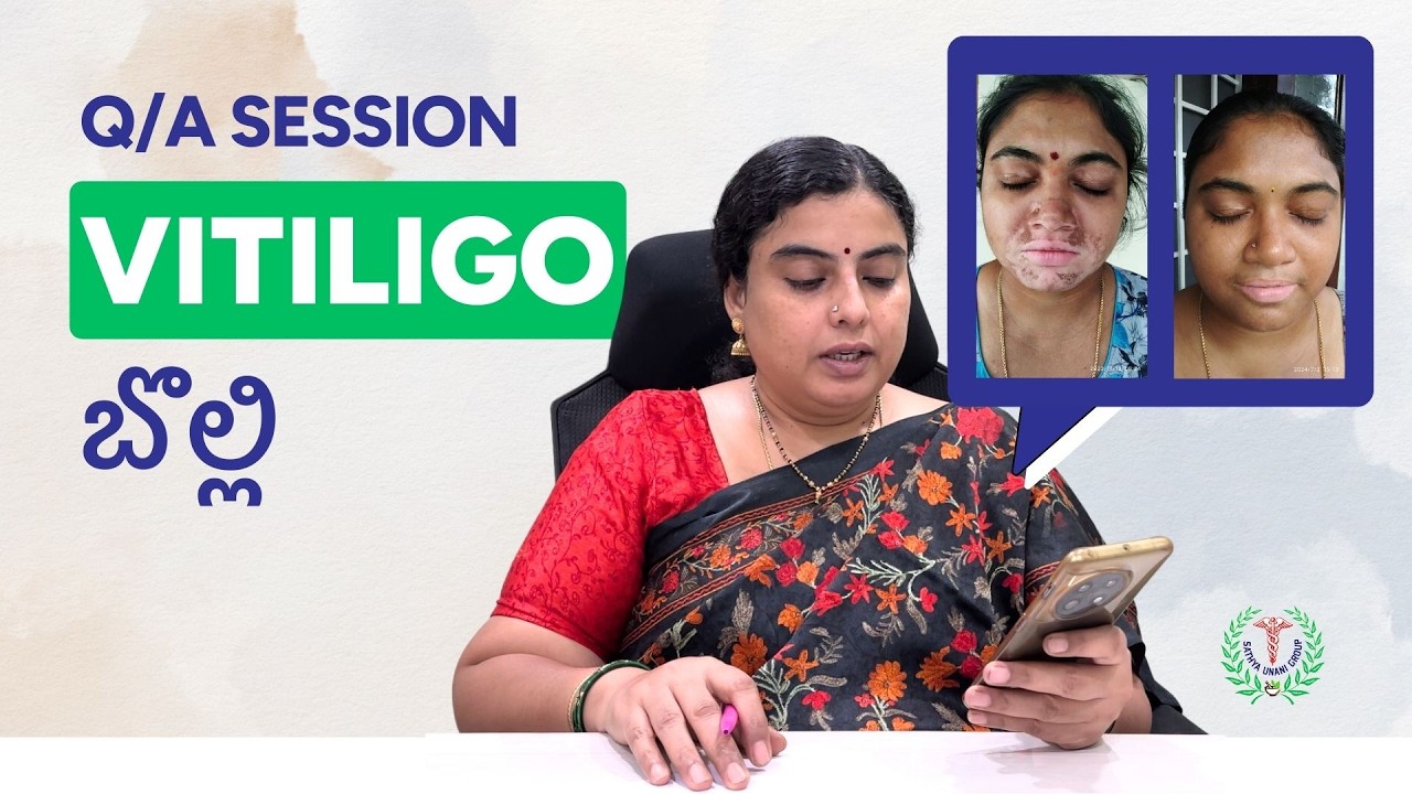 Question & Answer | Vitiligo | Dr.S.G.V Sathya | Sathya Unani | తెలుగు