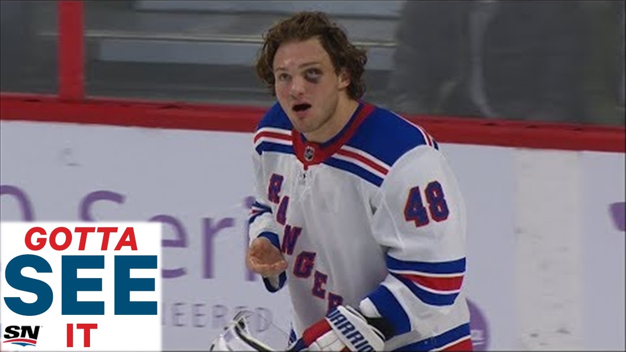 GOTTA SEE IT: Brendan Lemieux Picks Tooth Up Off The Ice After High Stick From Christian Jaros
