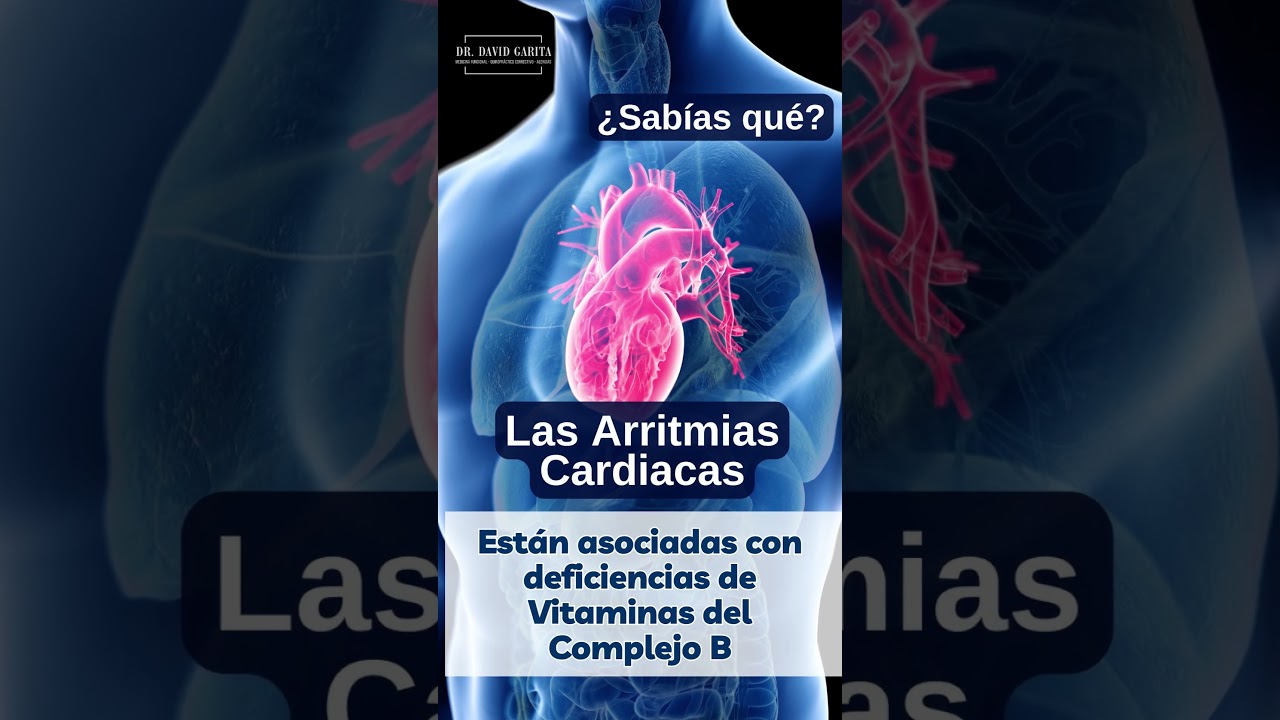 &iquest;Las Arritmias Cardiacas por qu&eacute; pasan? #arritmia #corazon
