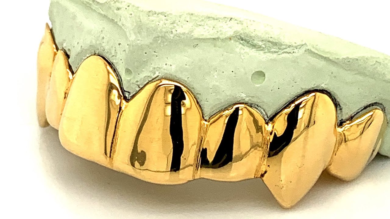 Can Grillz Work If I Have Crooked Teeth?  CHECK THIS OUT!!