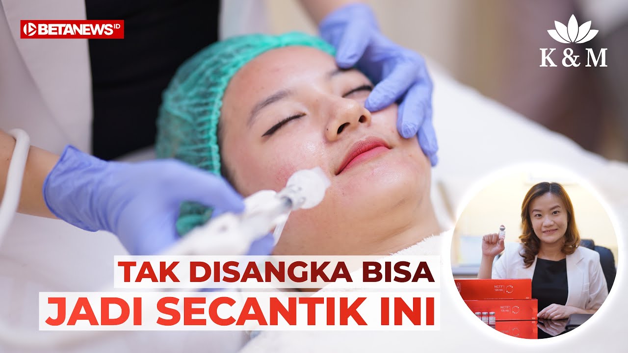 Perawatan Wajah di Klinik K&M Kudus dengan Skin Booster NCTF 135 HA