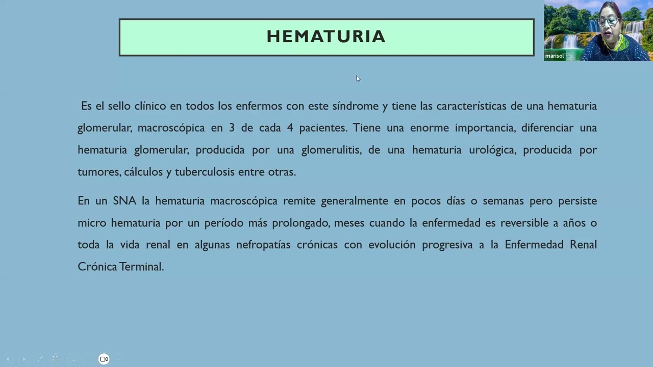 síndrome nefrítico agudo