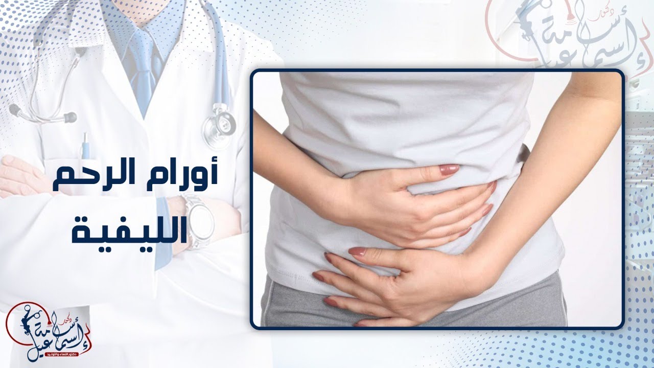 أورام الرحم الليفية - دكتور أسامة إسماعيل