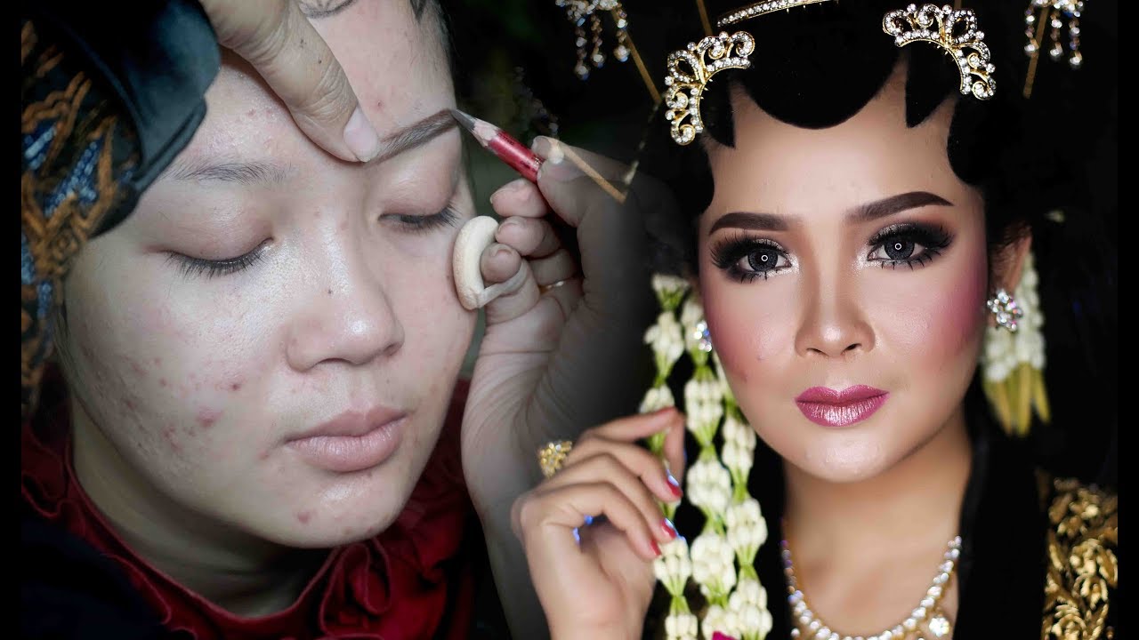 cara mengatasi PENGANTIN SOLO PUTRI Berjerawat? NO PROBLEM .....