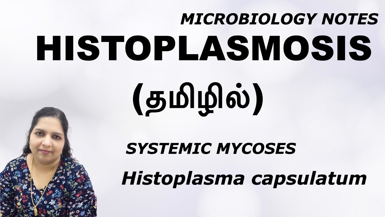 Histoplasmosis / Systemic Mycosis / Histoplasma capsulatum/ Dr. Blessy / Microbiology notes / Tamil