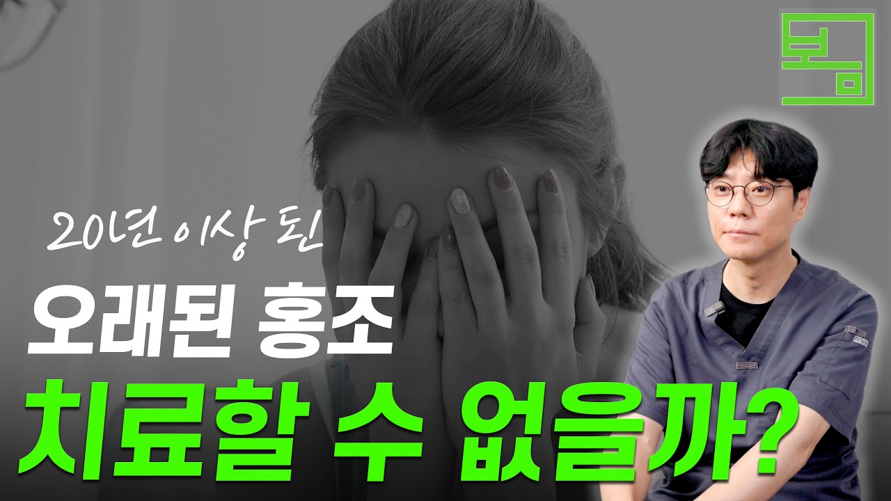 20년, 30년 넘은 안면홍조, 치료가 될까?