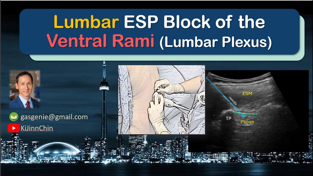 Lumbar ESP Block - for Hip & Lower Limb Analgesia