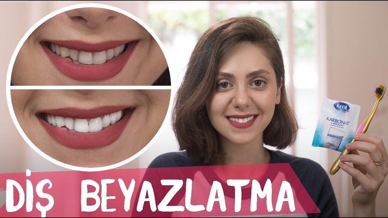 Evde Diş Beyazlatmak İçin 5 Doğal Yöntem!