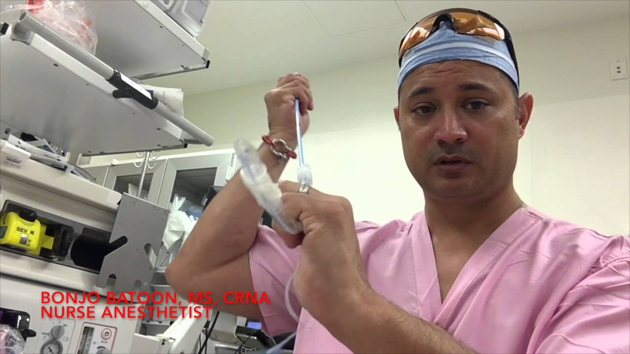 Bougie styletted ETT intubation aka Bonjo's bougie technique