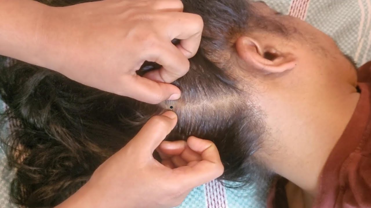 ASMR Scalp Check: The Most Relaxing Experience Ever(Real Person)✨