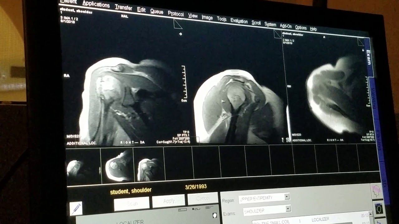 School of Medical Imaging MRI Lab - Shoulder Part I