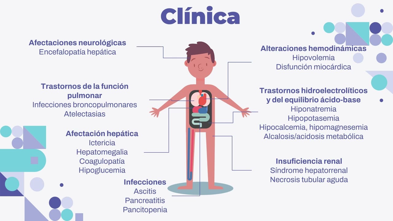 Hepatitis fulminante en pediatría