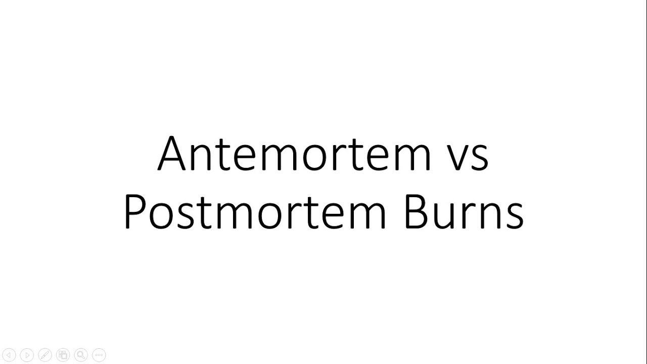 Antemortem vs Postmortem Burns - Forensic Medicine (FMT)