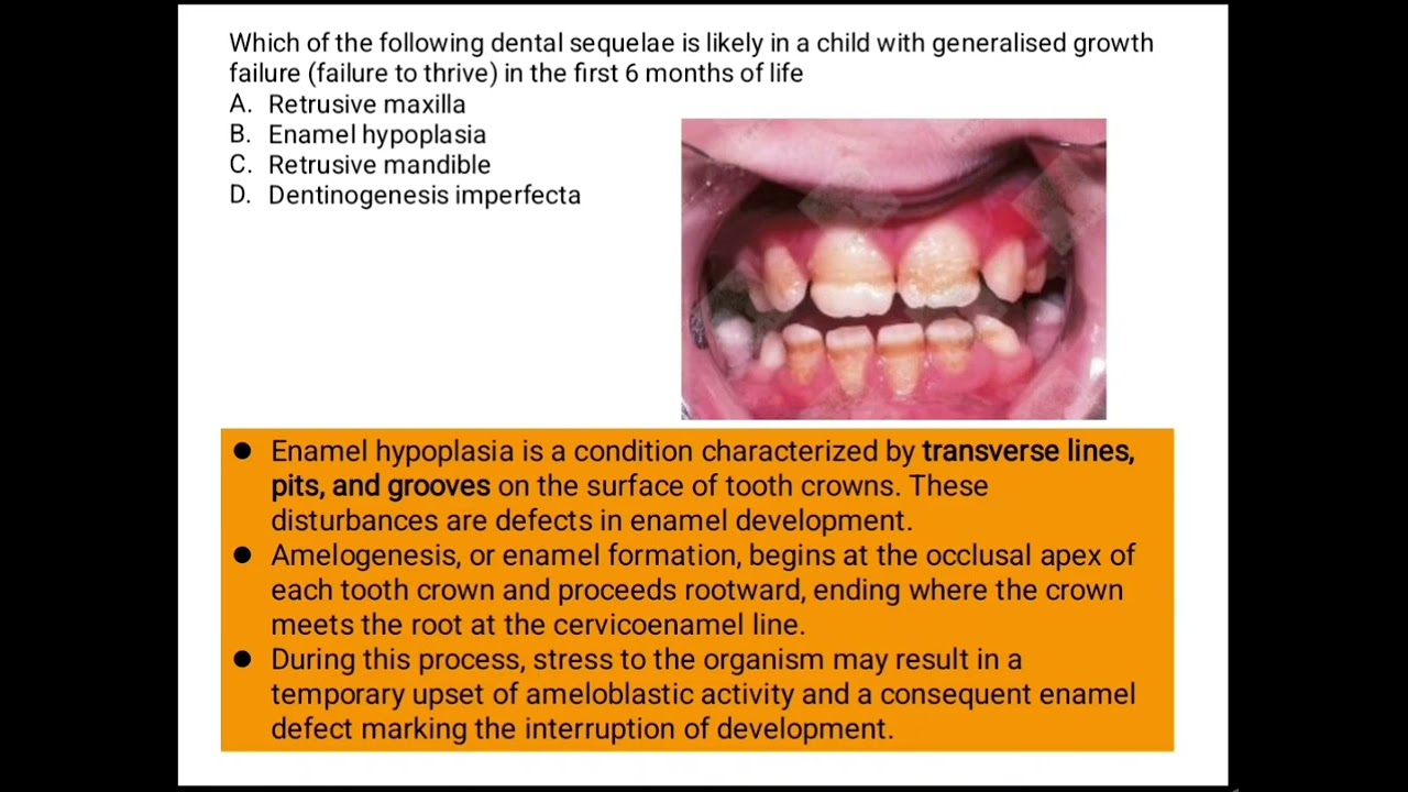 Oral Pathology Doubts - I , Explainer videos