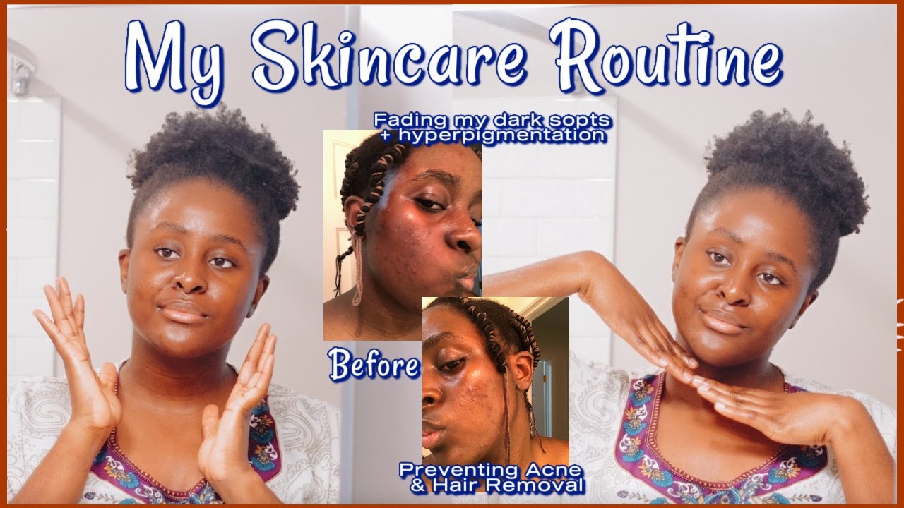 My Skincare Routine | Daily & Weekly Routines for Dark Spots + Hyperpigmentation, Acne, Hair Removal
