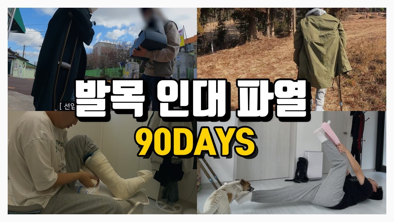 발목 인대가 끊어진 김에 찍은 영상