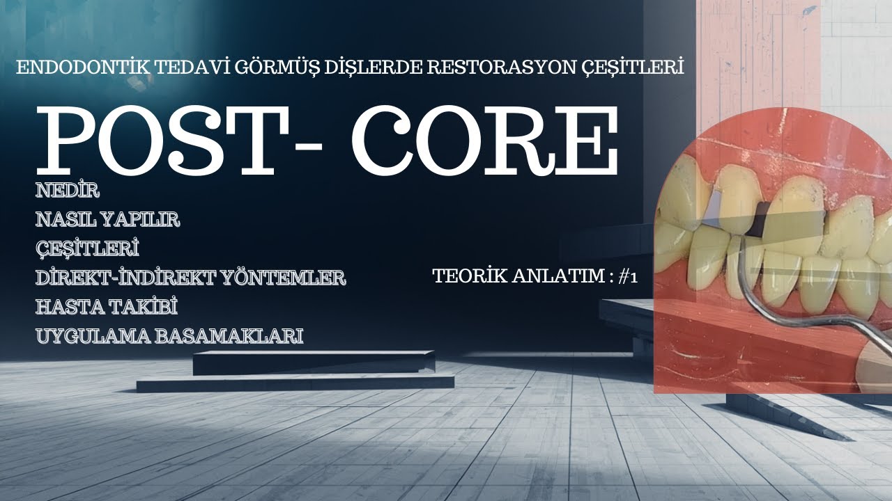 Post-Core Teorik Anlatım