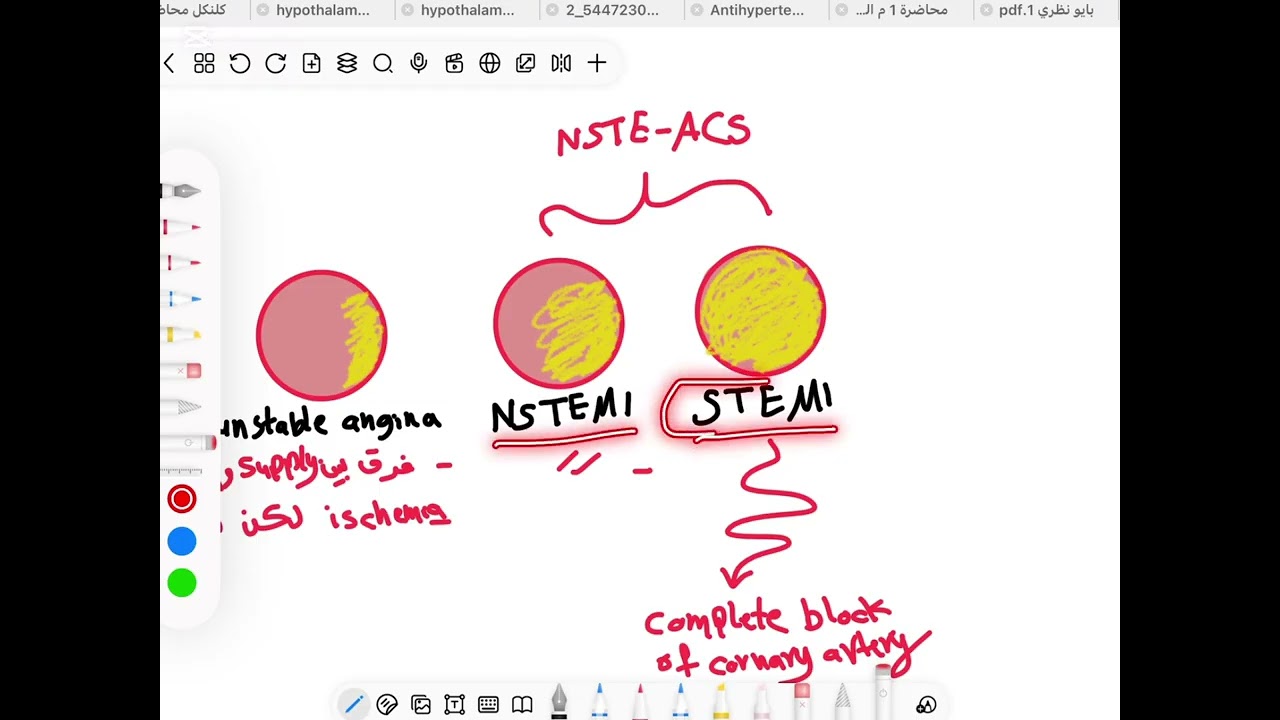 ACS part1  applied therapeutics 