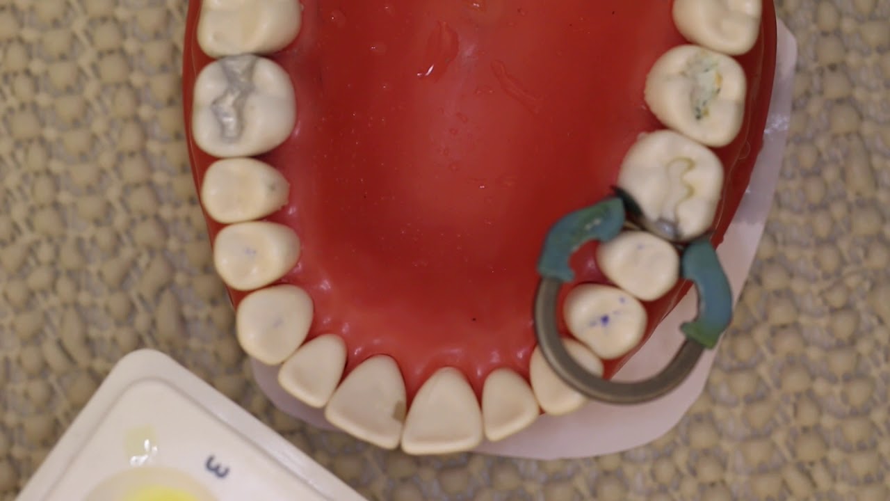 Etch and Rinse Adhesive System