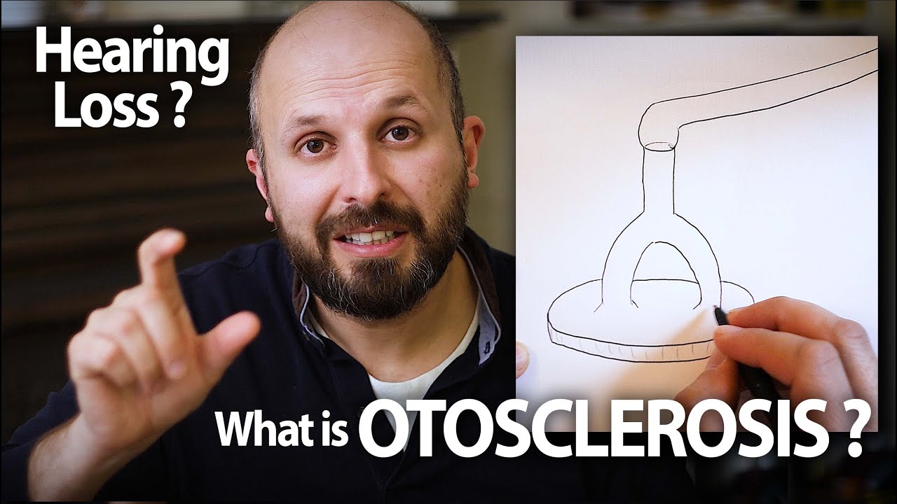 How to fix hearing loss if you have Otosclerosis (stapedectomy)