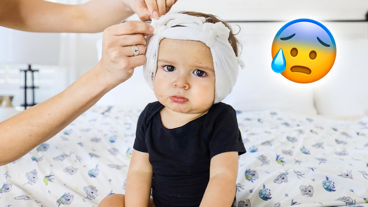 UNVEILING BABY NEO'S NEW EARS POST SURGERY | Unexpected Results!!!