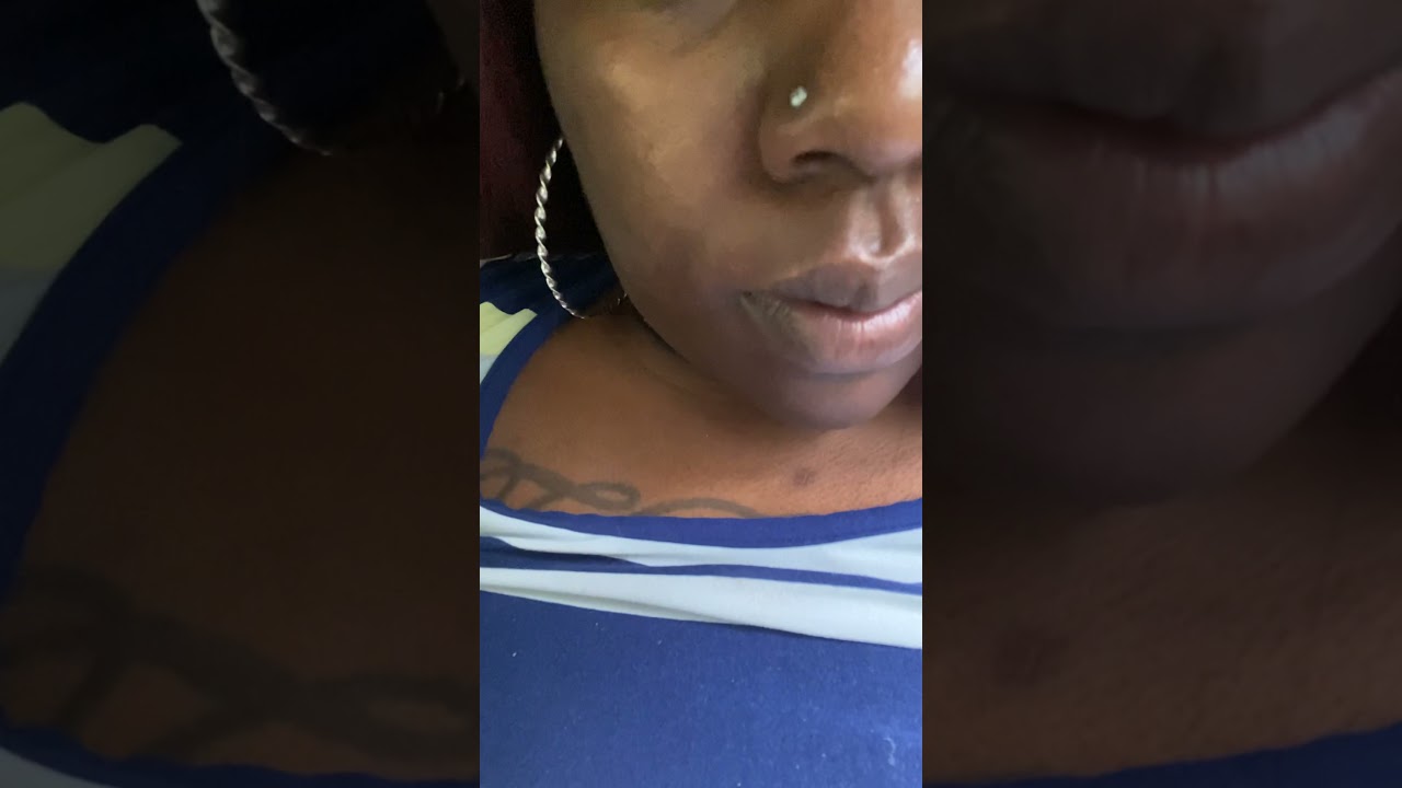 Nose flaring