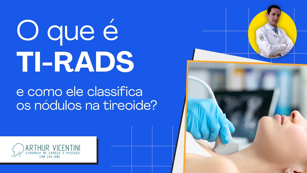 O que é TI-RADS e como ele classifica os nódulos na tireoide? | Dr. Arthur Vicentini CRM-SP 154.086