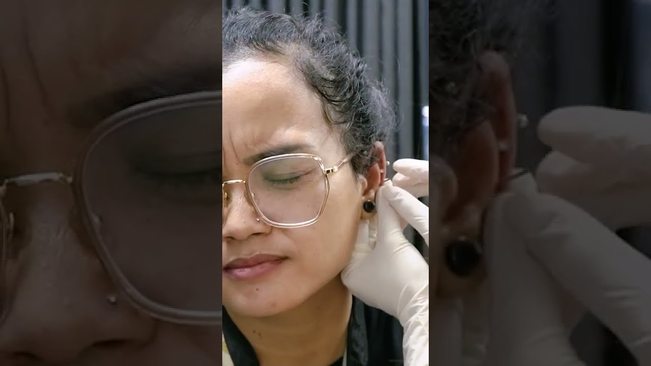 Tindik Telinga Helix Piercing Semarang