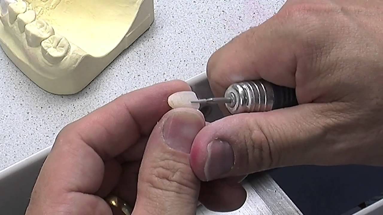 Trimming central incisor