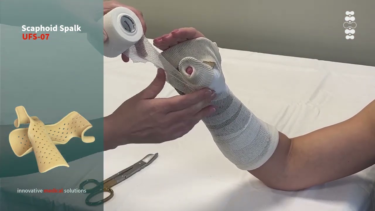 GeniMedical Scaphoid Spalk UFS 07