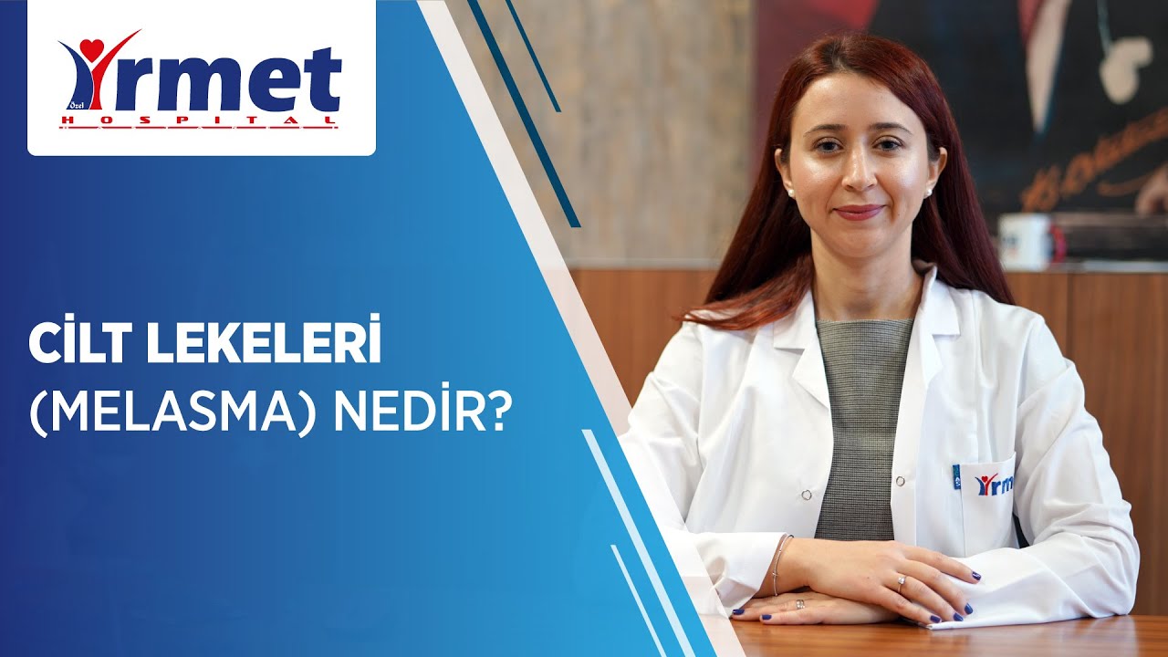 Cilt Lekeleri (Melasma) Tanı ve Tedavi Yöntemleri