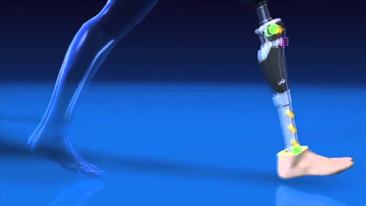 How the C Leg Works