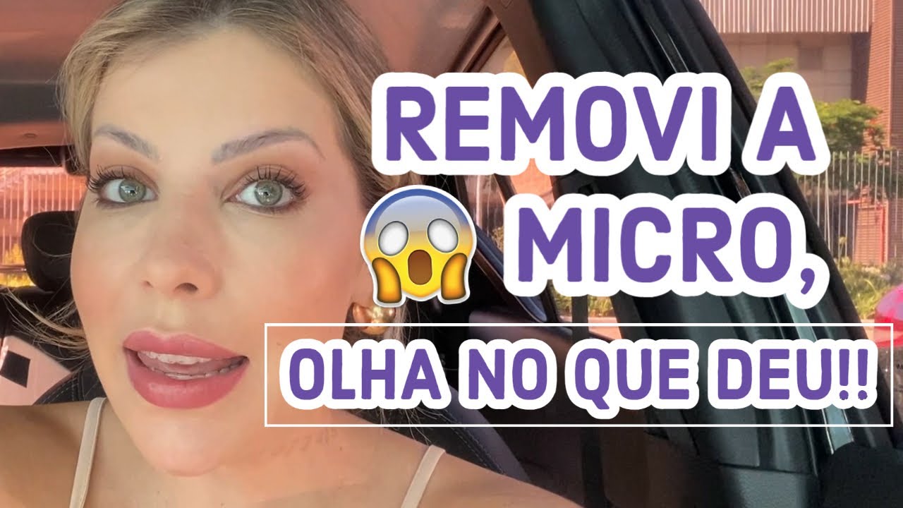 REMOÇÃO DA MICRO, REUNIÃO E PAPO FURADO