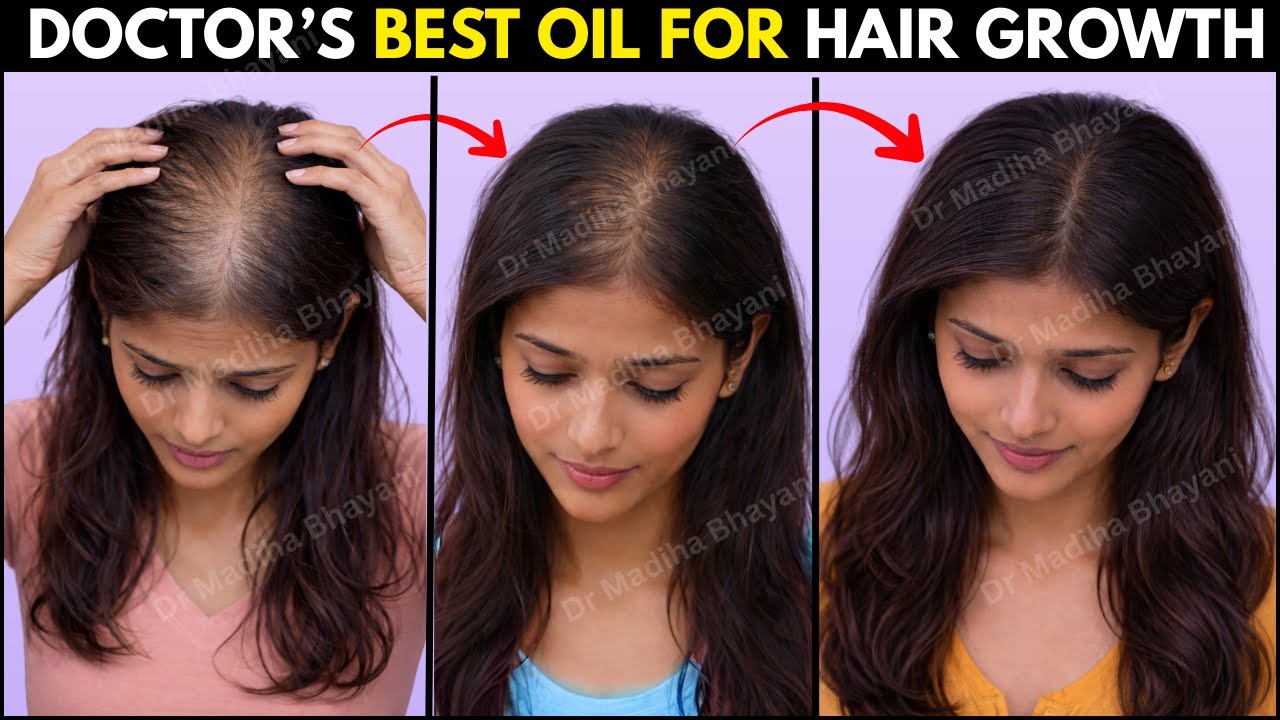 This Hair Growth Oil Grew my Hair Faster (Scientific Ingredients) | Coriander Oil for Hair growth