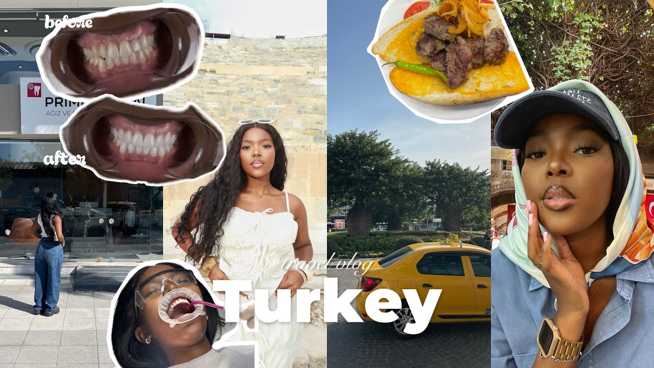 I got my teeth done in Turkey and this is what happened... | TRAVEL VLOG