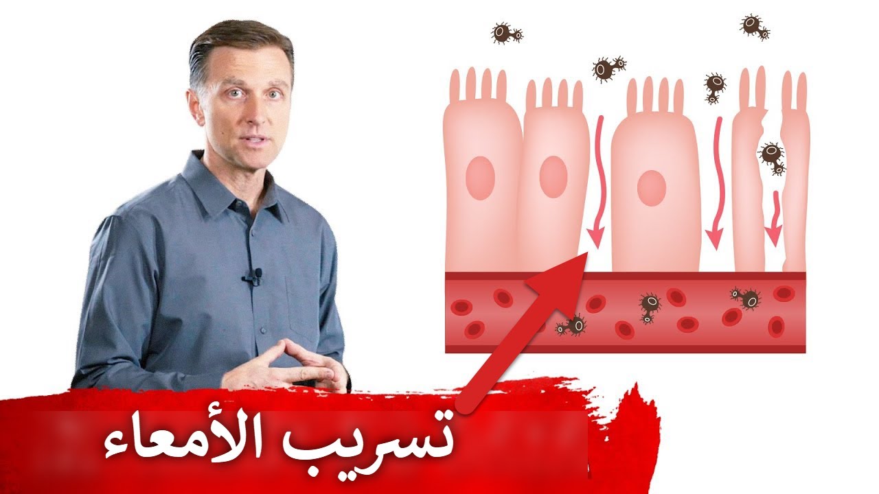 تسريب الامعاء قد يكون وراء العديد من الأمراض