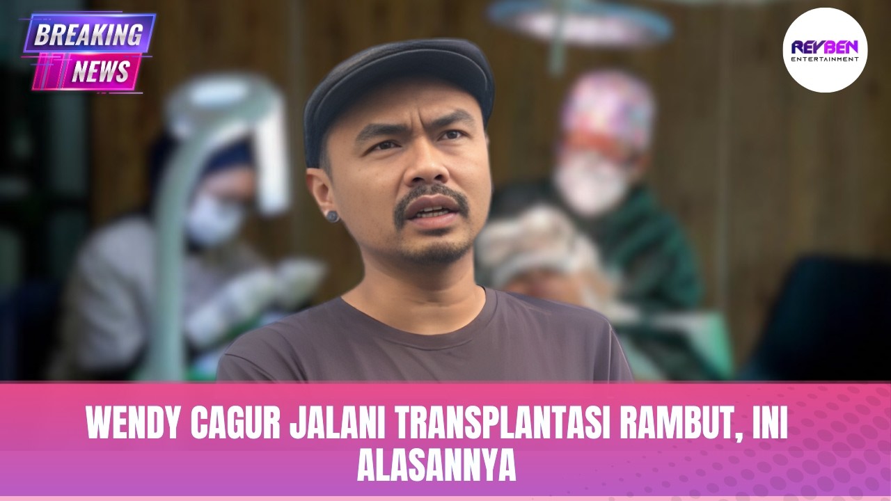 WENDY CAGUR JALANI TRANSPLANTASI RAMBUT, INI ALASANNYA