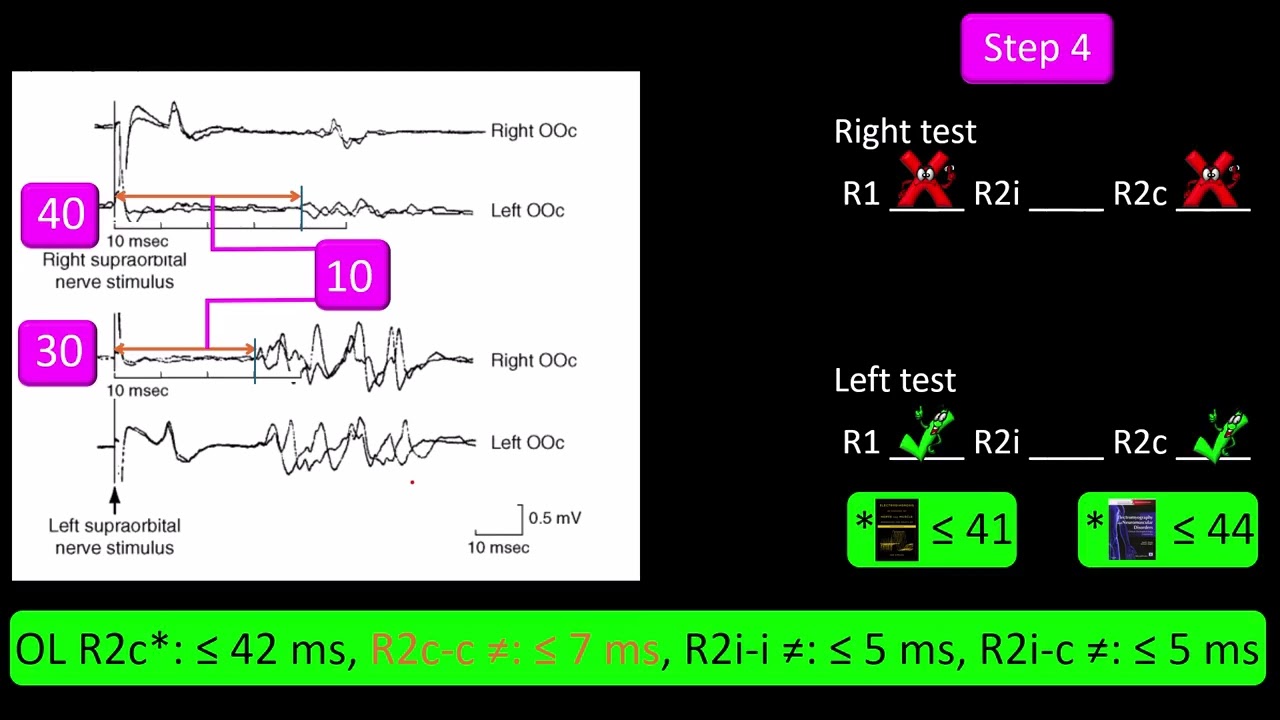 Blink Reflex Test. Practice 3