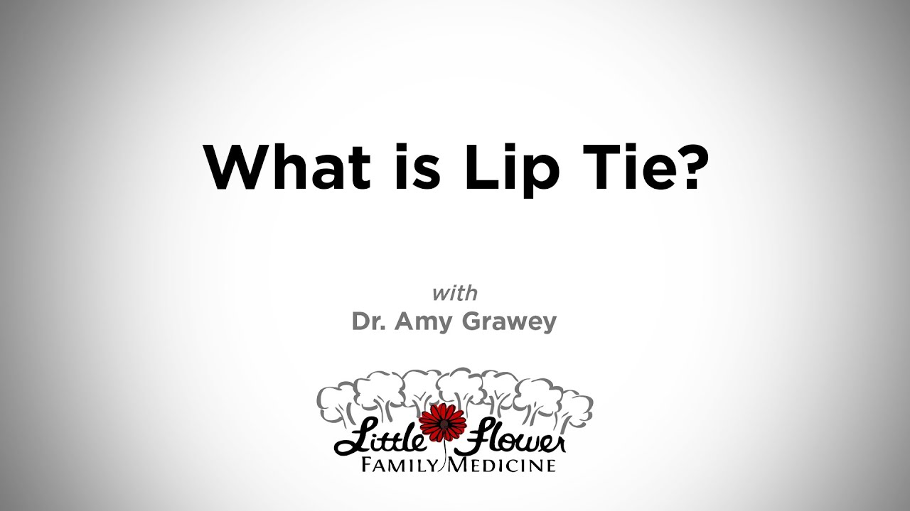 What is Lip Tie?